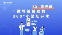 微導管輔助的360°小梁切開術